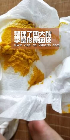 整理了四大秋季整形原因及适合做的下整形项目“九游体育”(图1) 九游体育